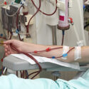 vascular-access-program vascular-access-program